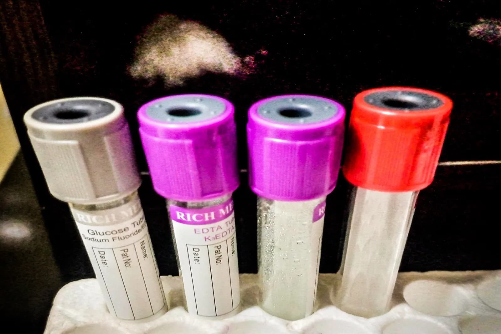 Four blood sample tubes with grey, purple and red caps standing in a rack